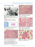Infectious Diseases Volume 2: Parasitic (eBook)