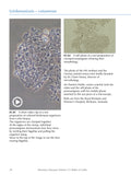 Infectious Diseases Volume 2: Parasitic (eBook)