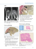 Infectious Diseases Volume 2: Parasitic (eBook)